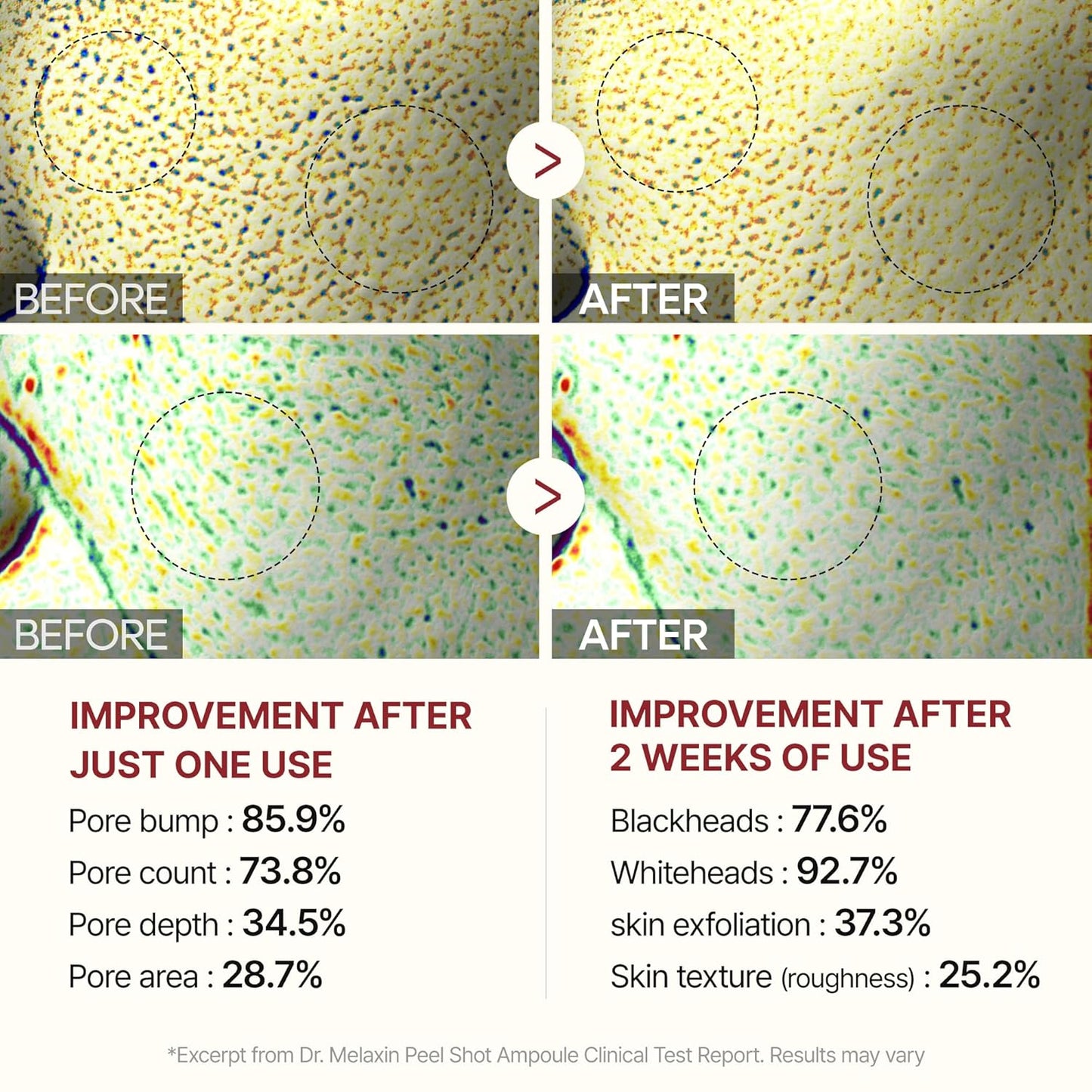 Peel Shot Glow Ampoule Duo